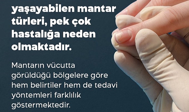 Gelibolu İlçe Sağlık Müdürlüğü'nden mantar hastalıklarıyla ilgili bilgilendirme