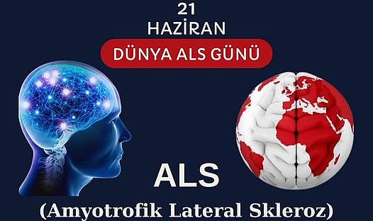 ALS'ye dikkat çekildi