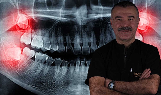 Yirmilik dişler ihmale gelmiyor! Uzmanı uyardı: Gülüşünüz bozulabilir