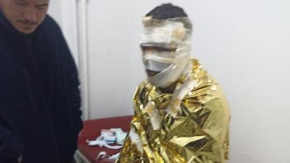 Erzurum'da kömür ocağında yangın: 2 işçi yaralı